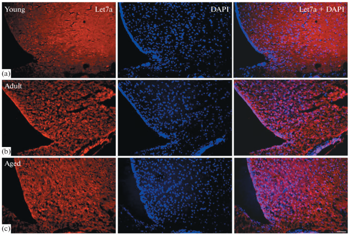 Let-7a MicroRNA Expression in the Mediobasal Hypothalamus during Aging