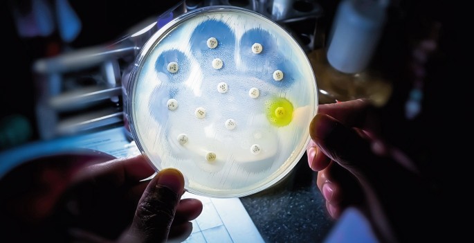 Antibiotika-Resistenzentwicklung: Bedeutung der Allergiediagnostik bei Antibiotika-/Penizillinallergie