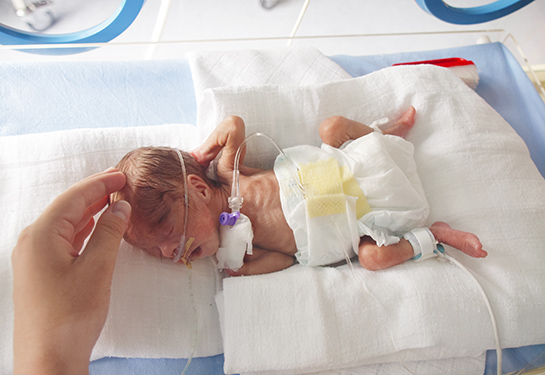 Delivering better care for premature infants with bronchopulmonary dysplasia