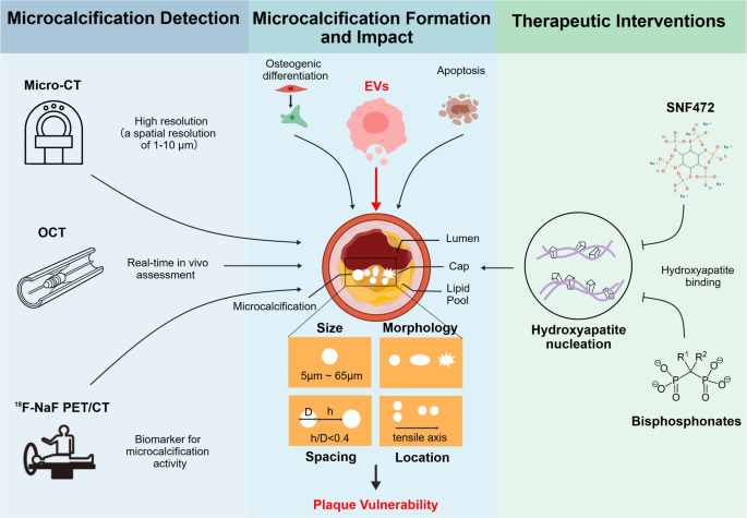 Microcalcification: Effects on Atherosclerotic Vulnerable Plaques, Detection, and Therapeutic Perspectives