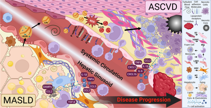 Metabolic Pathways Linking Atherosclerotic Cardiovascular Disease With Metabolic Dysfunction-Associated Steatotic Liver Disease