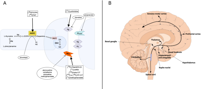 The Noradrenergic Brain in Parkinson’s Disease
