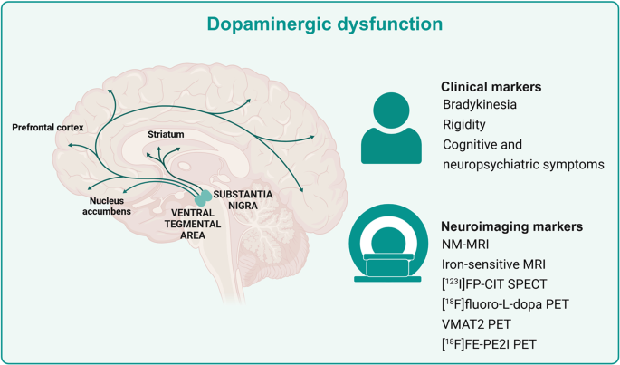 Mapping the Silent Onset of Parkinson’s Disease: Monoamine Imaging in the Era of the Race for Preclinical Intervention