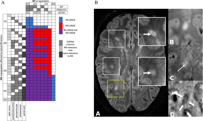 When is the Radiologically Isolated Syndrome already Multiple Sclerosis According to the 2024 McDonald Criteria?