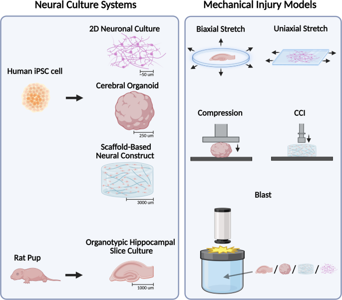Preclinical Models of Traumatic Brain Injury: Advances in  Models