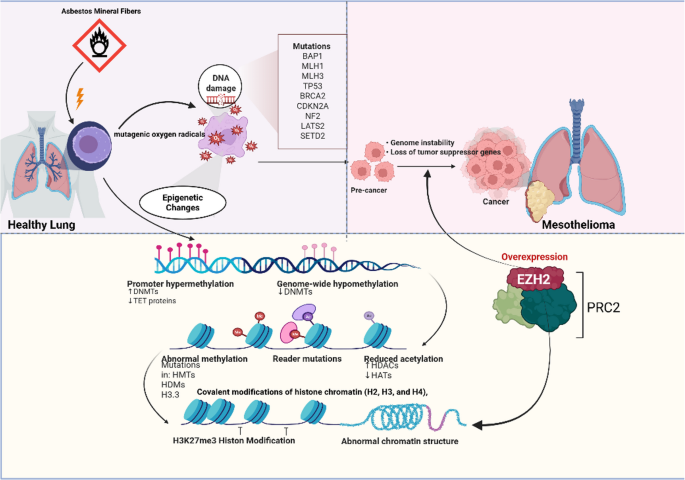 The Role of EZH2 in Malignant Pleural Mesothelioma and Beyond: Current Practice and Future Perspectives