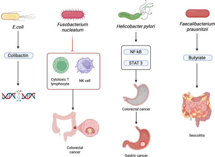 Microbiome in Gastrointestinal Tumors: Implications in Oncogenesis and Therapeutic Response