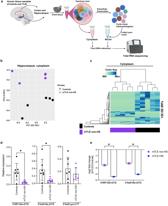 Inhibition of tRNA fragments dysregulated in human mTLE exacerbates pathology and seizure activity