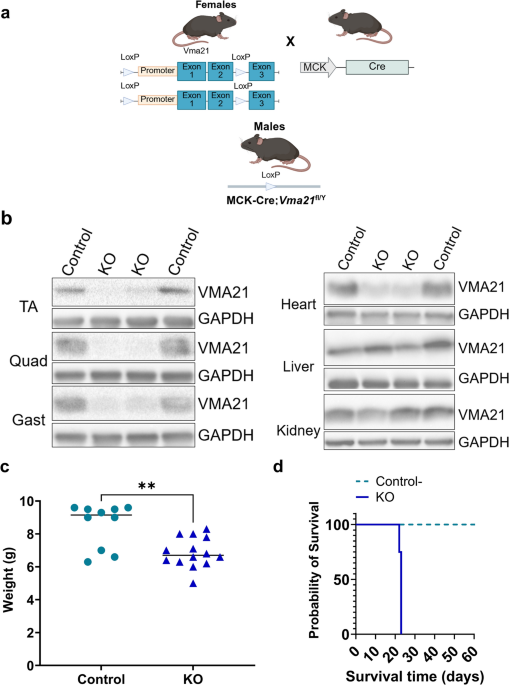 VMA21 deficiency leads to autophagic dysregulation and altered vesicle trafficking in X-linked myopathy with excessive autophagy