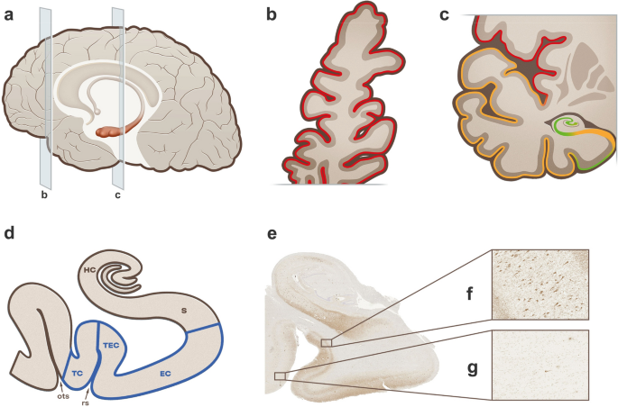 Expression of GPR34 in microglia remains stable in human Alzheimer’s disease