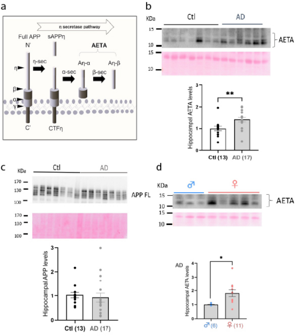 AETA peptide contributes to Alzheimer’s disease signature of synapse dysfunction