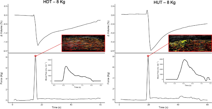 The influence of aging on graded peripheral venous return and complex blood flow features through human veins