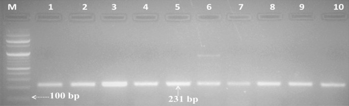 Association of two LEP gene SNPs with reproductive performance in pigs: Potential markers for genetic selection