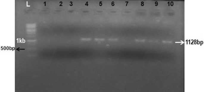 In vitro cleavage validation assay of myostatin gene by CRISPR-Cas9 ribonucleoprotein complex: from PCR amplification to cleavage assay