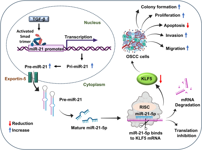 Transforming growth factor-beta (TGF-β) mediated induction of miR-21-5p drives oral squamous cell carcinoma (OSCC) progression through suppression of KLF5
