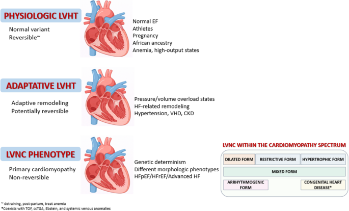 Left ventricular non-compaction in heart failure: contemporary perspective on diagnostic challenges and treatment opportunities