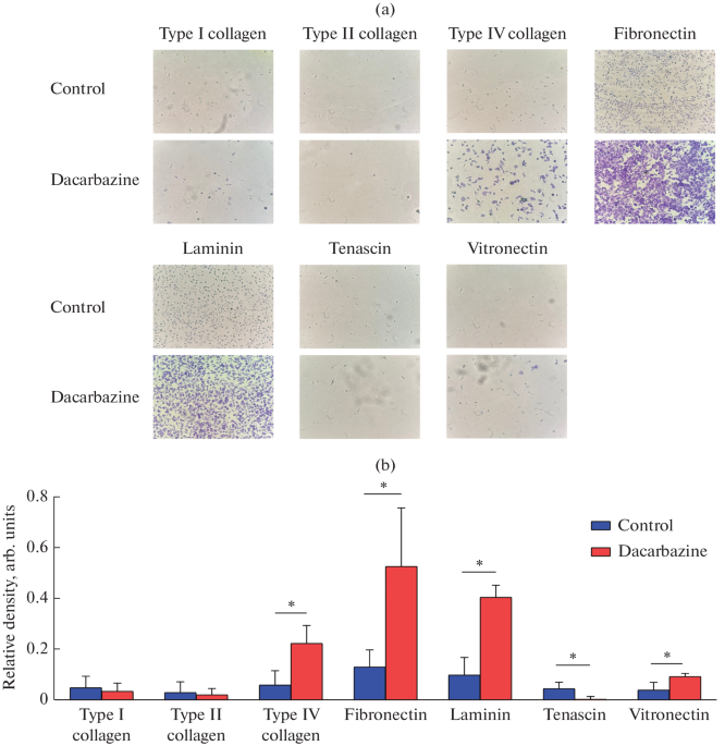 Dacarbazine Increases Melanoma BRO Cell Adhesion to the Extracellular Matrix Components