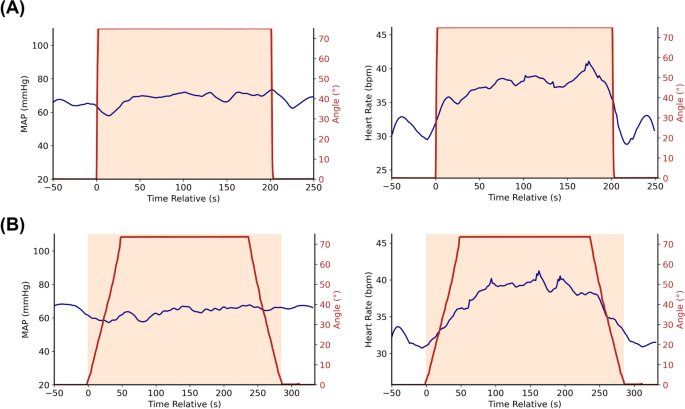 Cardiovascular digital twin personalization using arterial blood pressure-driven optimization of a Windkessel–baroreflex model