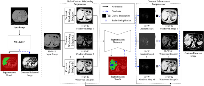Deep learning-based multi-contrast windowing for task-specific medical image visualization