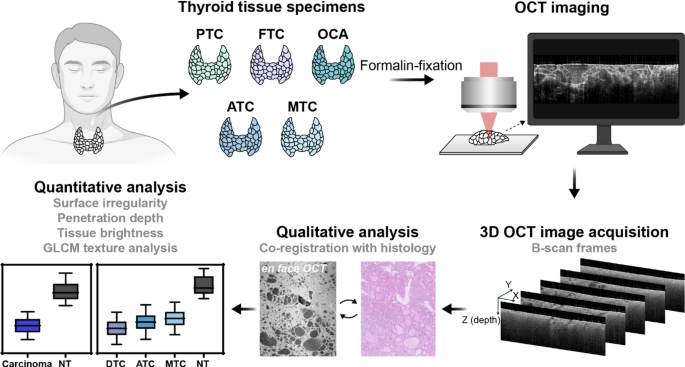 Optical coherence tomography for broad spectrum of thyroid carcinoma: a qualitative and quantitative analysis