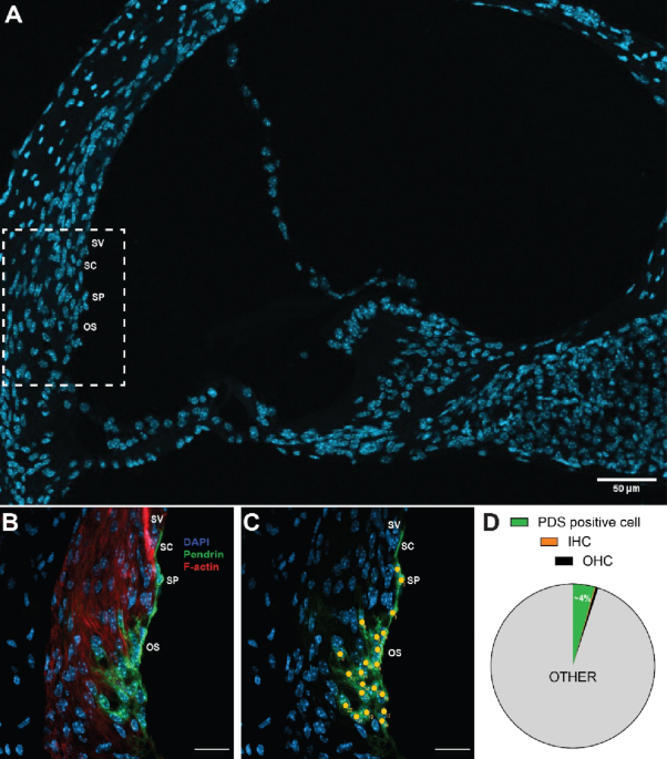 Identification of a novel isoform of  by single-cell RNA-sequencing of pendrin-expressing cells in the cochlea