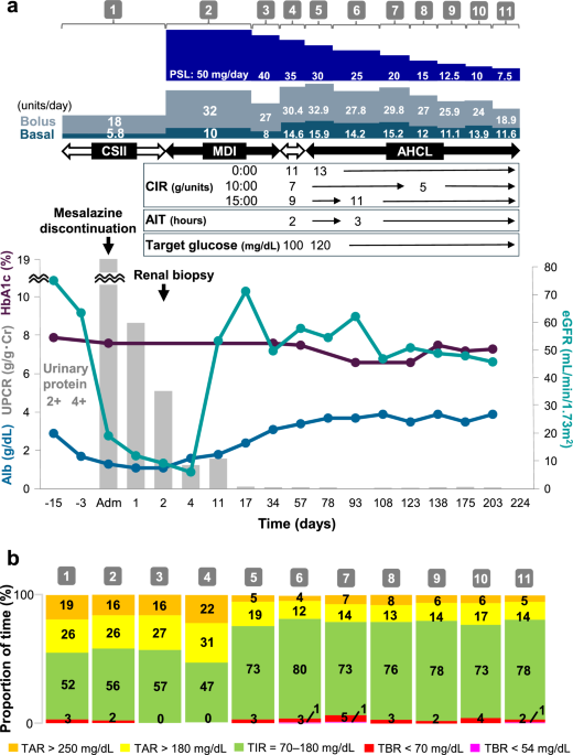 Minimal change disease in a patient with type 1 diabetes and Crohn’s disease managed with advanced hybrid closed-loop insulin therapy during corticosteroid treatment