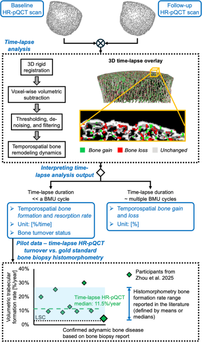 Time-Lapse HR-pQCT: an in Vivo Imaging-Based Assessment of Bone Remodeling Dynamics