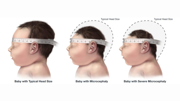Zika Virus: Challenges and Advances on an Ongoing Threat