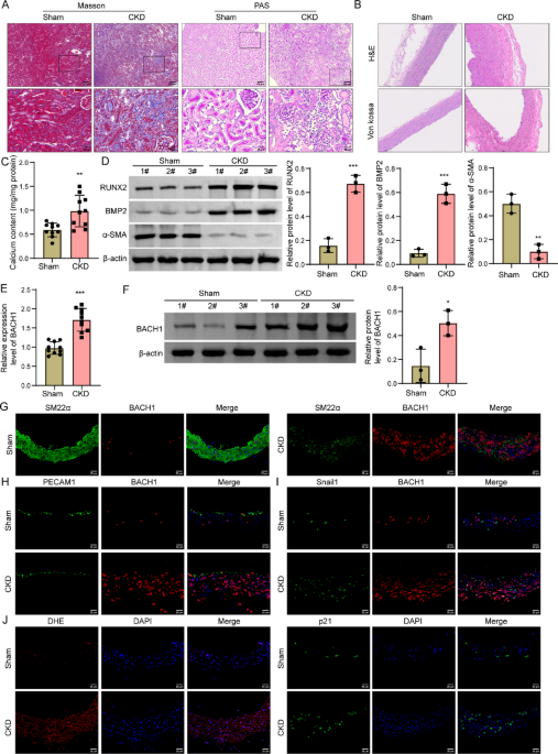 Cellular crosstalk between endothelial and vascular smooth muscle cells via the BACH1/COL3A1 axis promotes vascular calcification in chronic kidney disease
