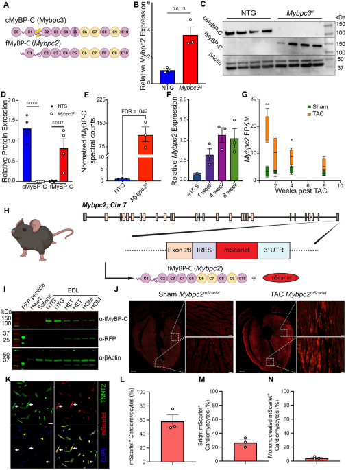 Fast skeletal myosin binding protein-C expression exacerbates dysfunction in heart failure