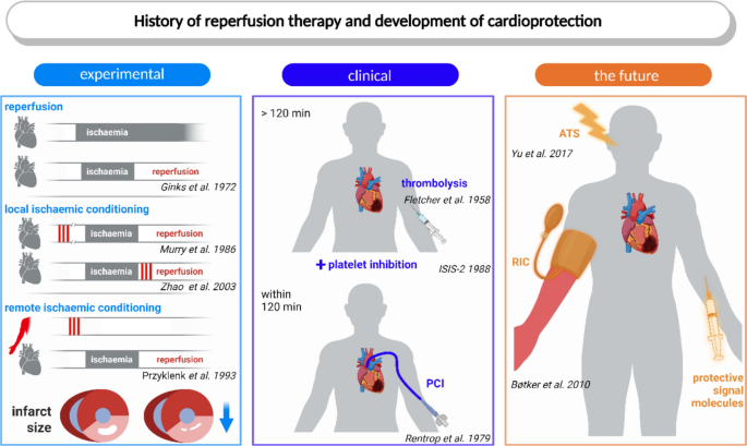 Historical account of reperfusion therapy and the development of cardioprotection beyond reperfusion