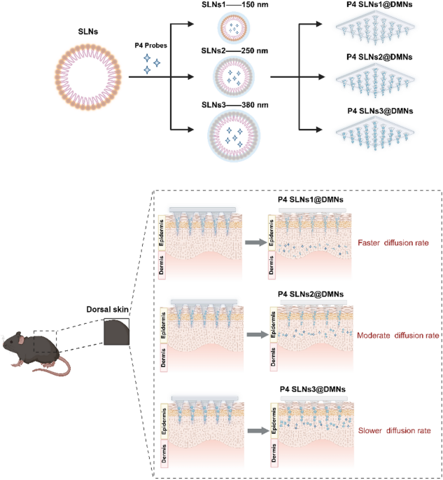 In vivo spatiotemporal fate of nanoparticle-incorporated dissolving microneedles: nanoparticle size effects