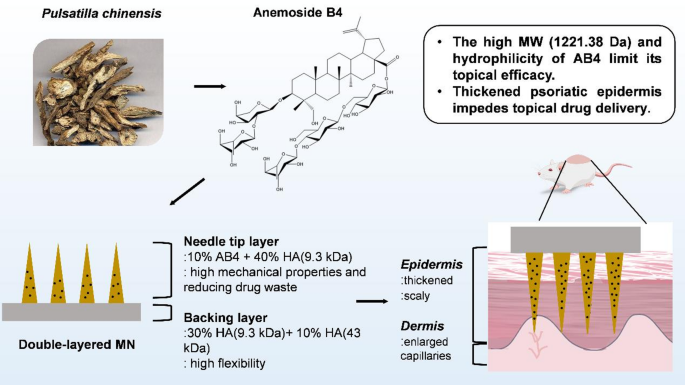 Dissolving microneedle delivery of anemoside B4: a strategy to enhance therapeutic efficacy against psoriasis