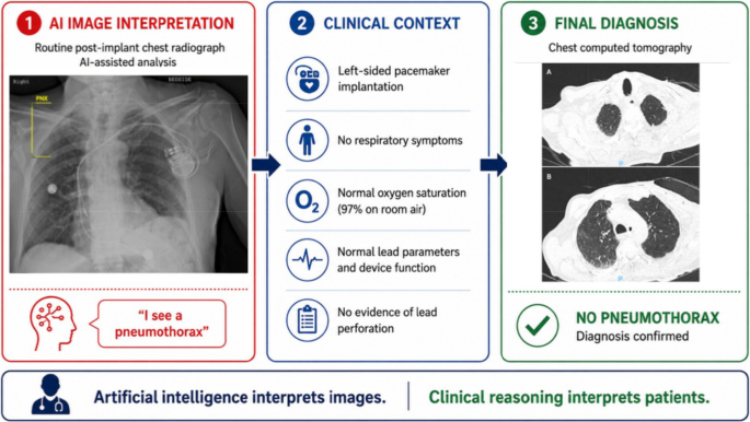 Artificial intelligence and the phantom pneumothorax: Clinical reasoning still matters