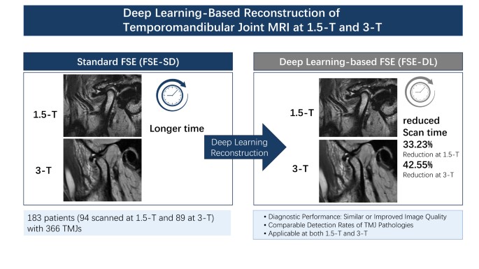 Deep Learning-Based Reconstruction of Temporomandibular Joint MRI at 1.5-T and 3-T