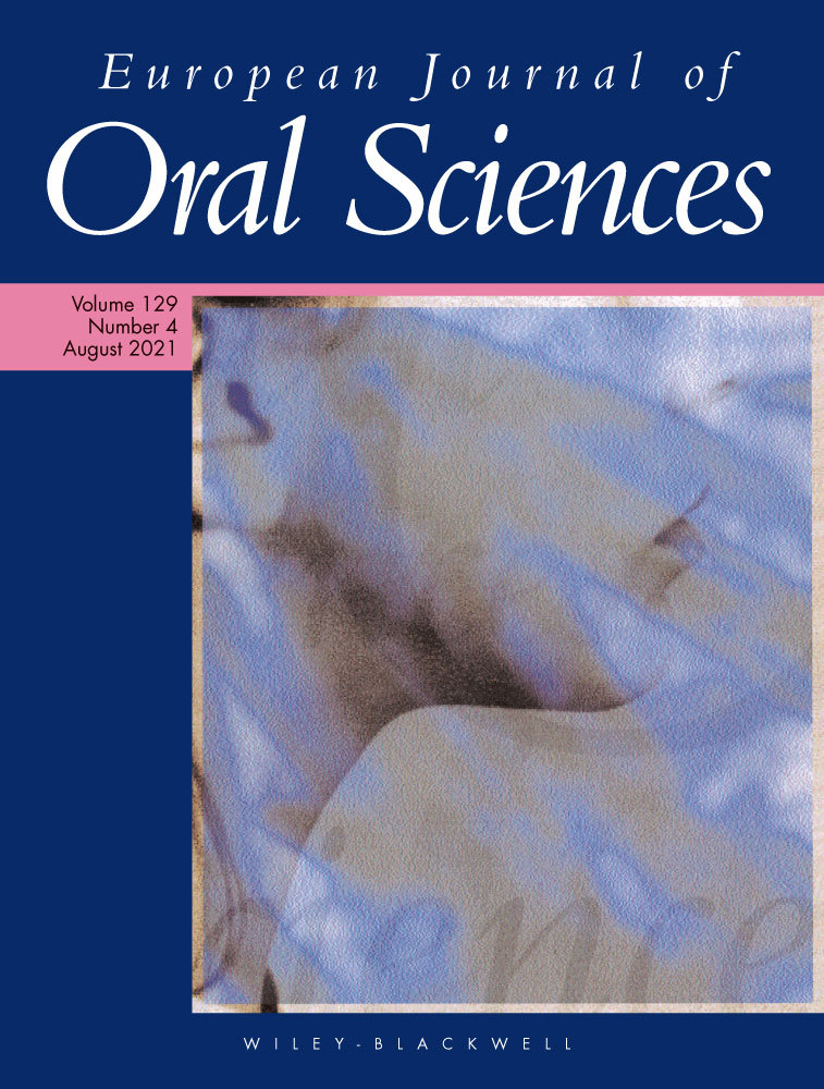 The effect of fascin 1 inhibition on head and neck squamous cell carcinoma cells