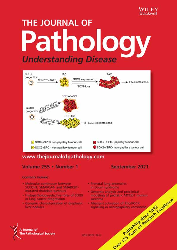 Cardiac–specific deletion of FDPS induces cardiac remodeling and dysfunction by enhancing the activity of small GTP–binding proteins