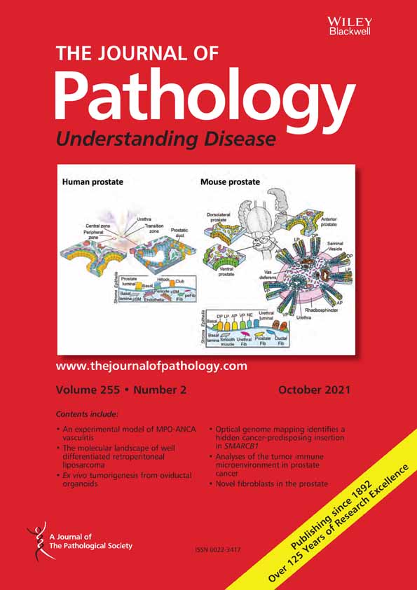 Ethanol‐induced formation of colorectal tumours and precursors in a mouse model of Lynch Syndrome