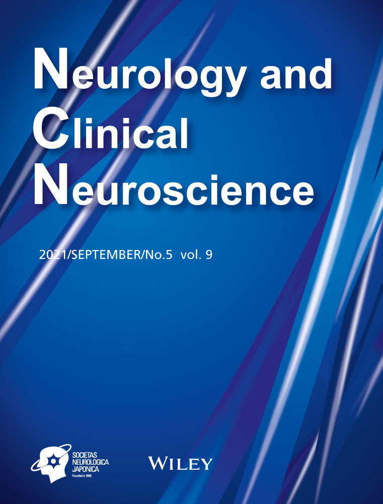 Internal carotid artery dissection due to Eagle syndrome: Case report and review of literatures