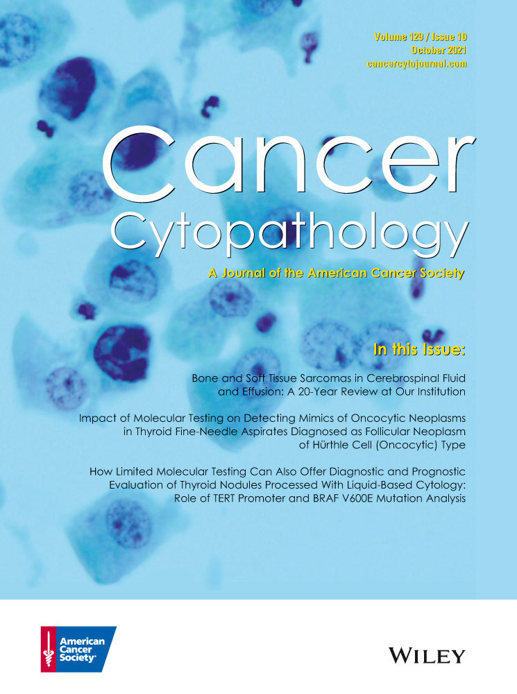 Giant cell tumor of soft tissue: FNA cytopathology of 4 cases, review of the literature, and comparison with giant cell tumor of bone
