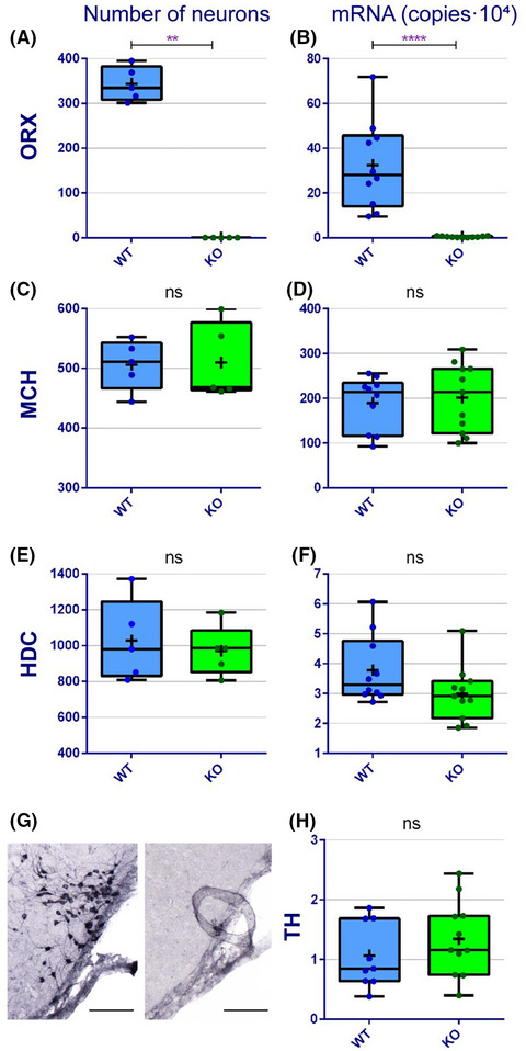 Histamine in murine narcolepsy: What do genetic and immune models tell us?