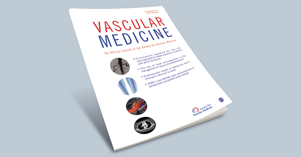 Images in Vascular Medicine: Bright light amaurosis – When external carotid artery stenosis matters