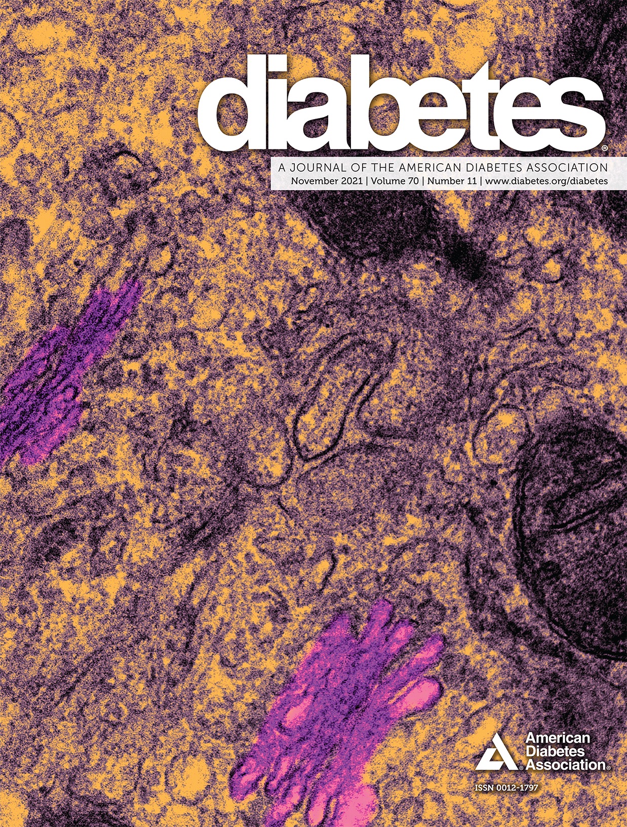 The Metabolic Significance of Intermuscular Adipose Tissue: Is IMAT a Friend or a Foe to Metabolic Health?