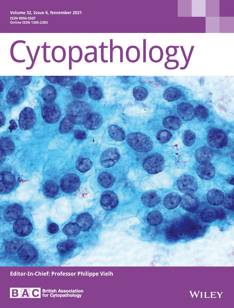 Scoring system for intraoperative diagnosis of intracranial schwannoma by squash cytology