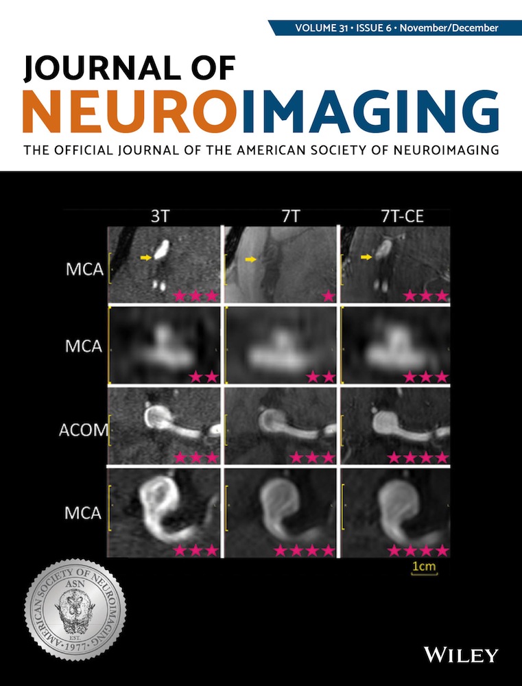 Diffusely abnormal white matter in multiple sclerosis