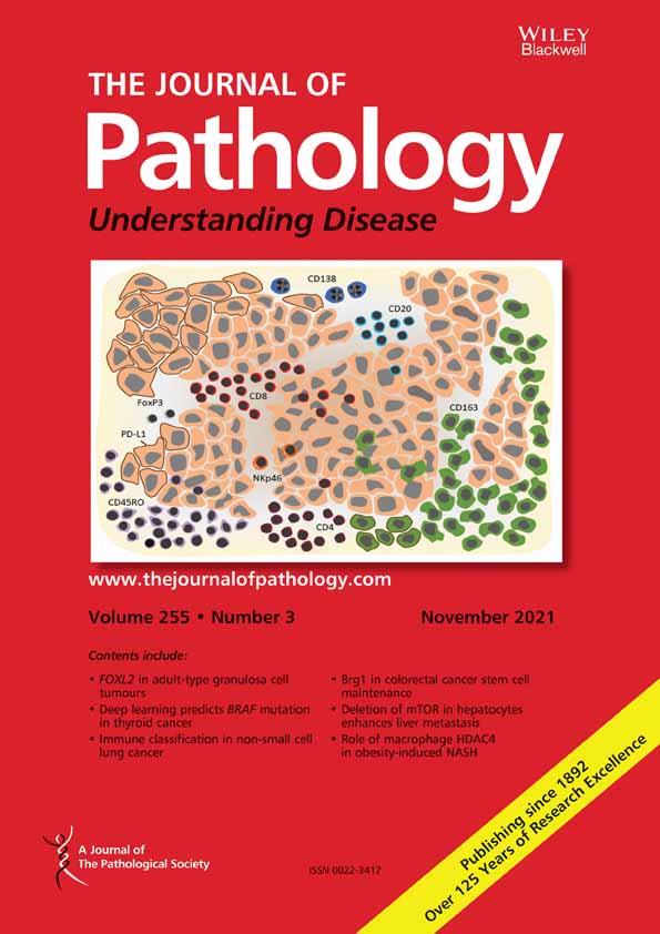 Cardiac decompensation and promiscuous prenylation of small GTPases in cardiomyocytes in response to local mevalonate pathway disruption†