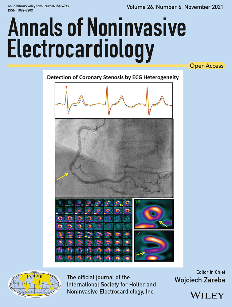 Altered cardiac autonomic function after recovery from COVID‐19