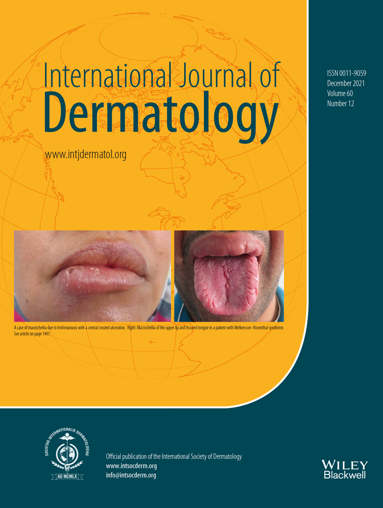 When to suspect a supressor of fused homolog (SUFU)‐associated basal cell nevus syndrome