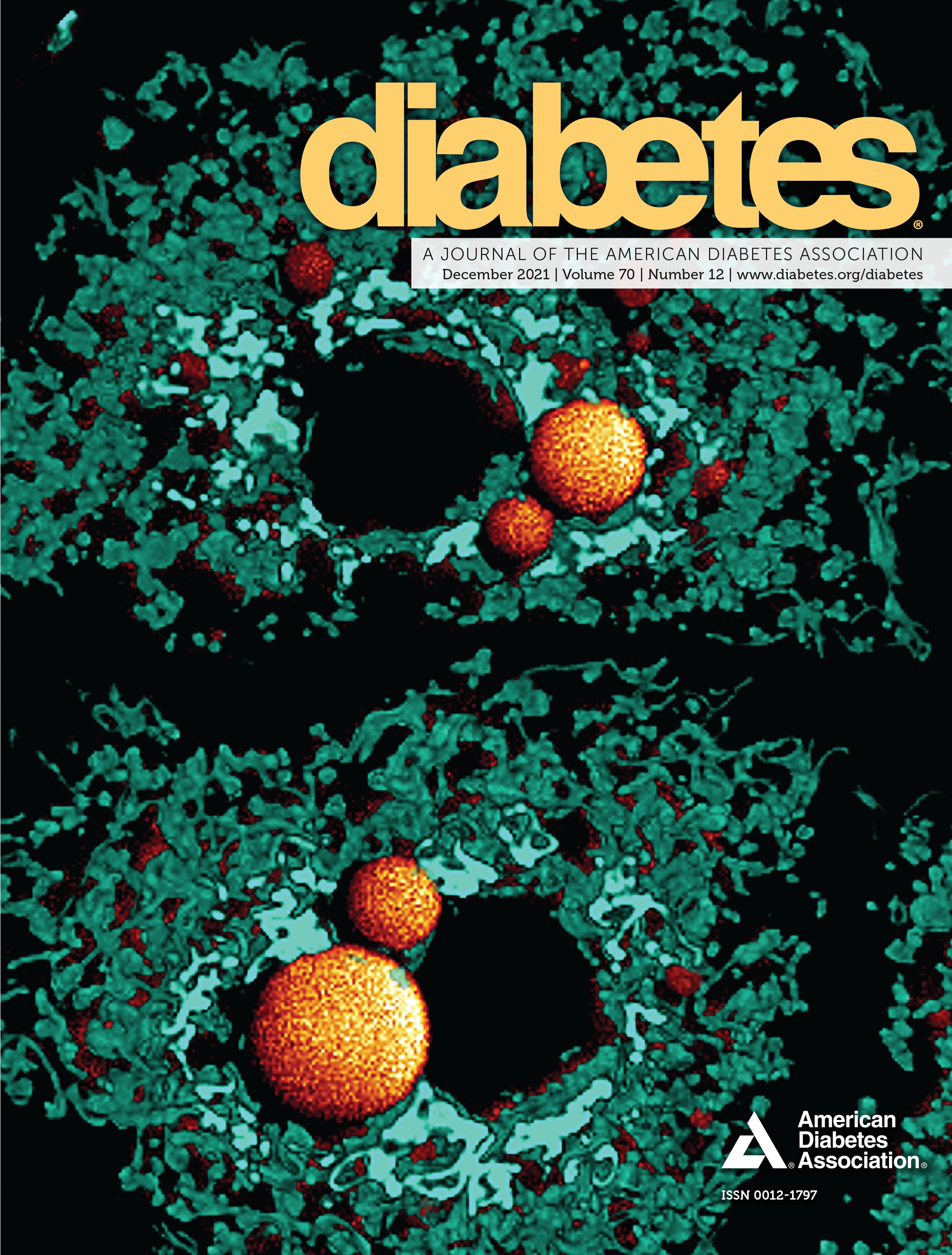Diabetes and the Risk of Long-term Post-COVID Symptoms