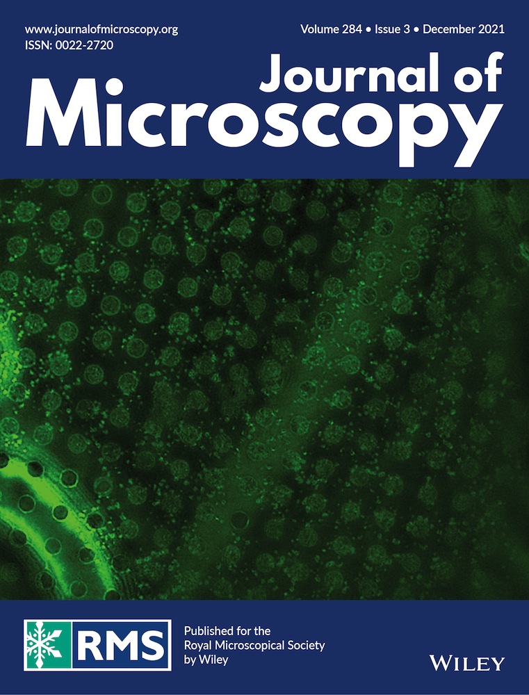 Analysing neutron radiation damage in YBa2Cu3O7‐x high temperature superconductor tapes